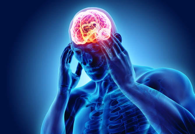 Migraine tips and management by homeopathy